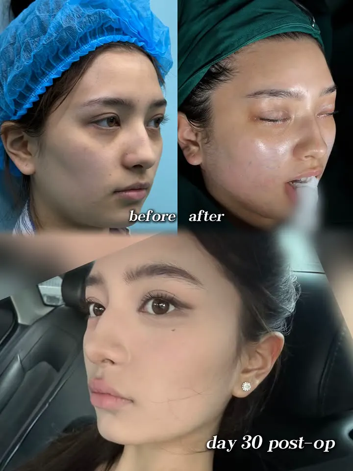 “Please don’t change my face.”