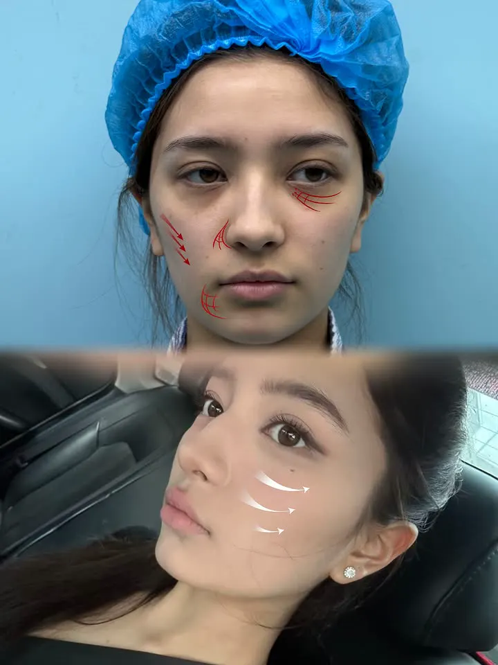 Facial planning and recovery