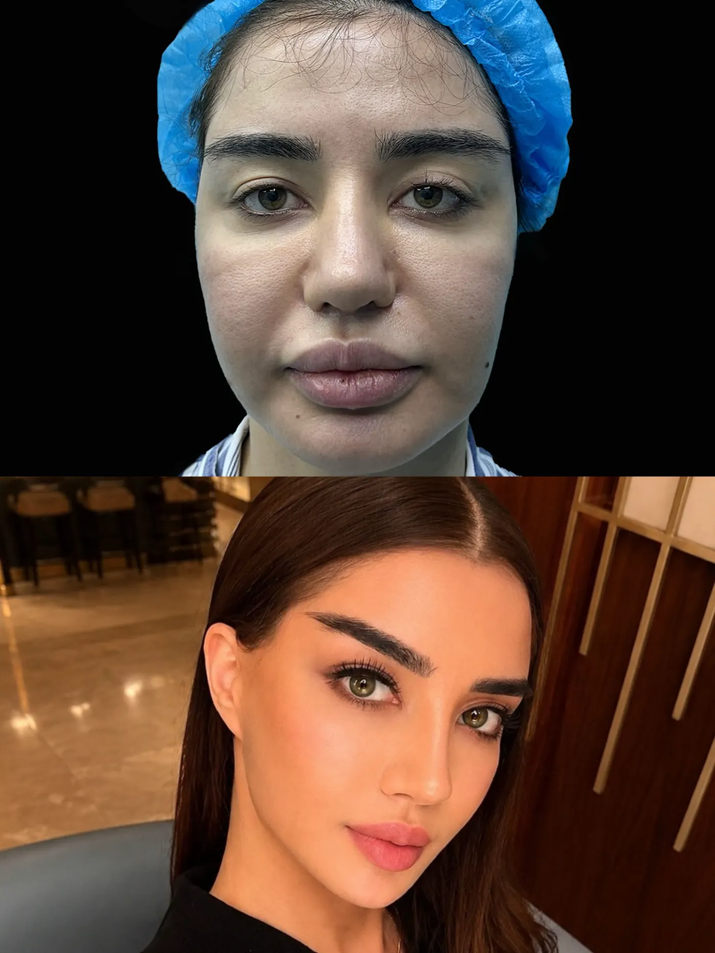 Türkiye patient preoperative and two-month return comparison